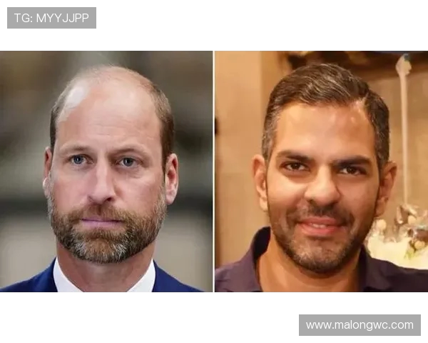 印度亿万富翁马球赛中吞蜂猝死 罕见过敏反应夺命(2)